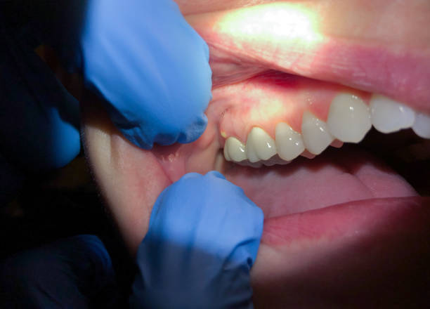 Best Holiday Emergency Dentist in Lake Holiday, VA