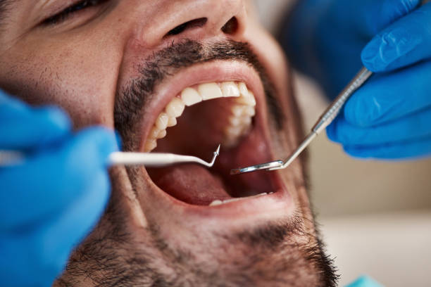 Best Mobile Emergency Dentist in Lake Holiday, VA
