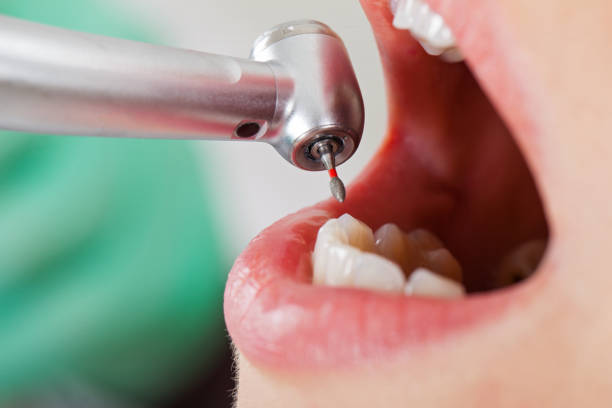 Best Urgent Dental Care for Toothache in Lake Holiday, VA